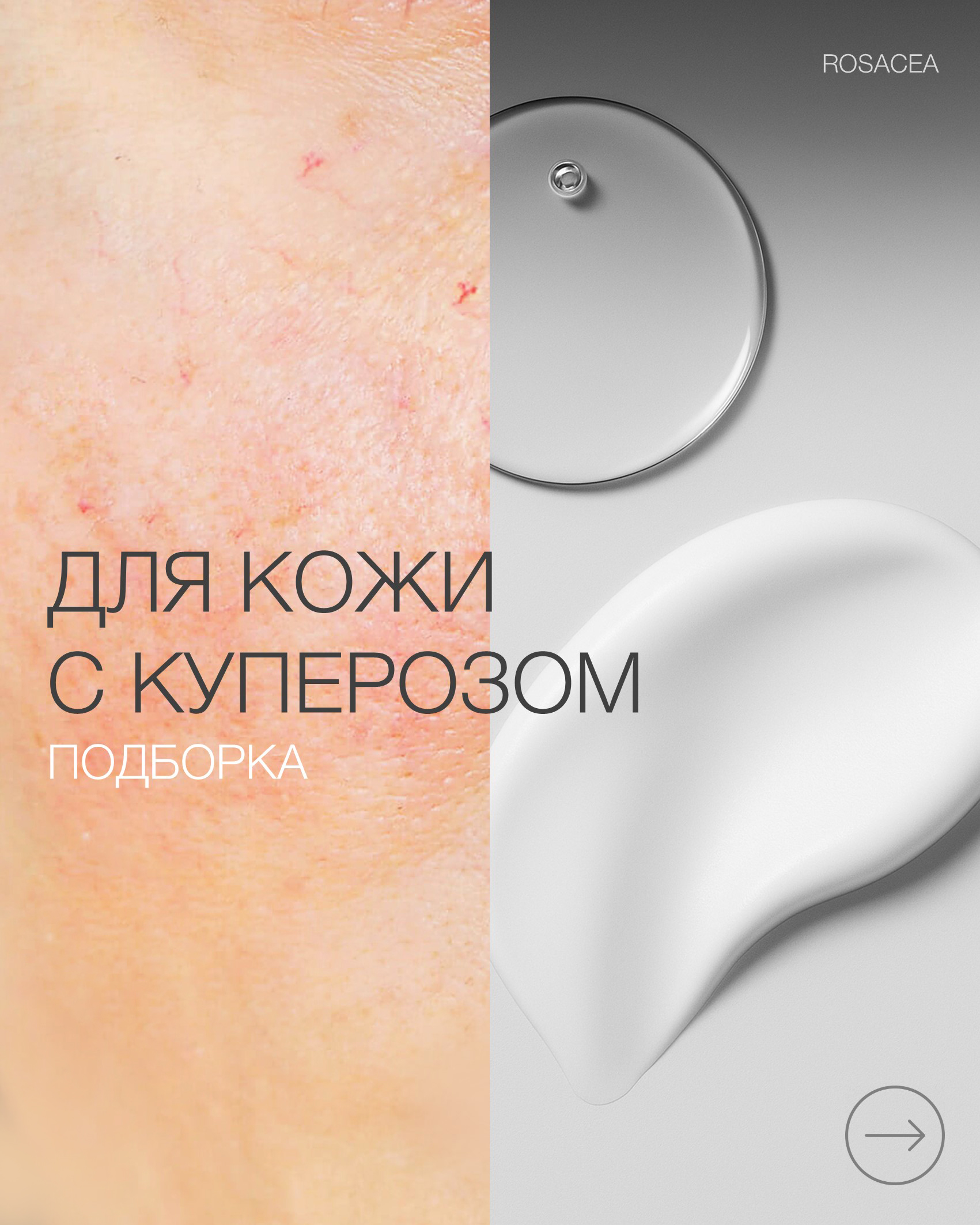 Пост купероз подборка 2.jpg Пост купероз подборка 2.jpg